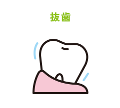 抜歯
