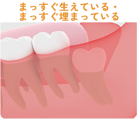 まっすぐ生えている・まっすぐ埋まっている